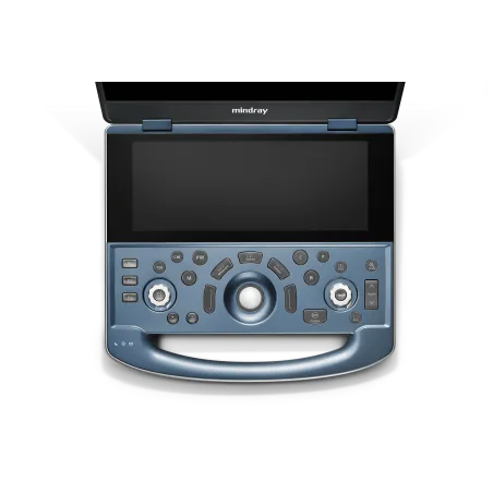Mindray MX7 – przenośny ultrasonograf klasy premium do zaawansowanej ultrasonografii klinicznej