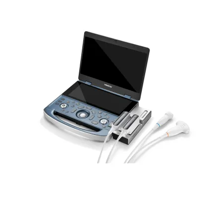 Mindray MX7 – przenośny ultrasonograf klasy premium do zaawansowanej ultrasonografii klinicznej