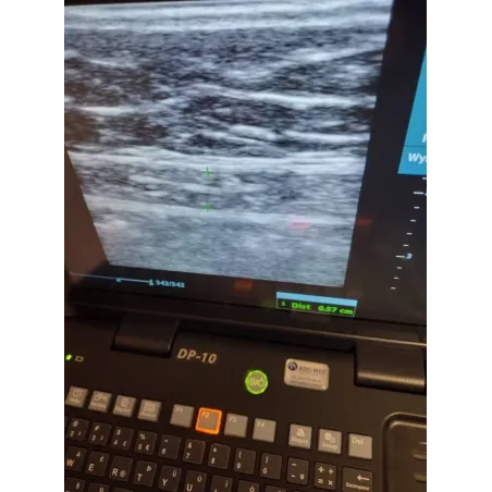 Mindray DP-10 z głowicą 75L38EB – używany ultrasonograf w bardzo dobrym stanie | 6000 zł
