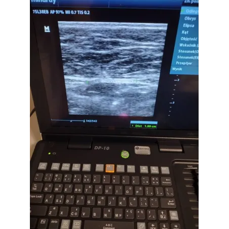 Mindray DP-10 z głowicą 75L38EB – używany ultrasonograf w bardzo dobrym stanie | 6000 zł