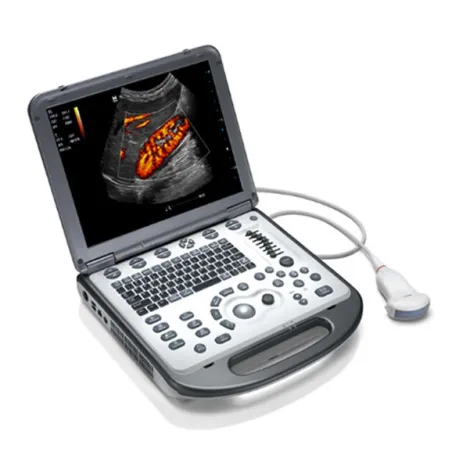 Aparat USG Mindray M6