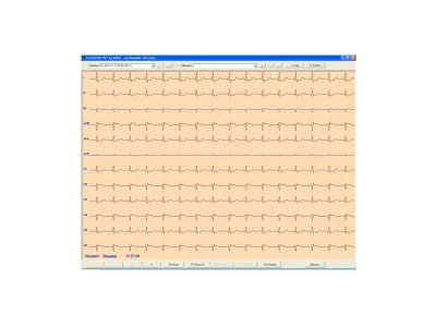 Oprogramowanie ASPEL Cardioteka – archiwizacja badań EKG