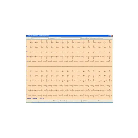 Oprogramowanie ASPEL CardioTEKA HL7