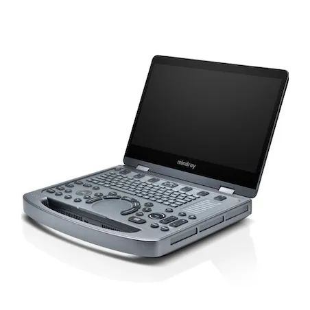 Mindray MX3 – przenośny aparat USG klasy premium do diagnostyki przyłóżkowej i w gabinecie