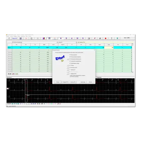 ASPEL HolCARD 24W – oprogramowanie do analizy Holtera EKG | EKG24