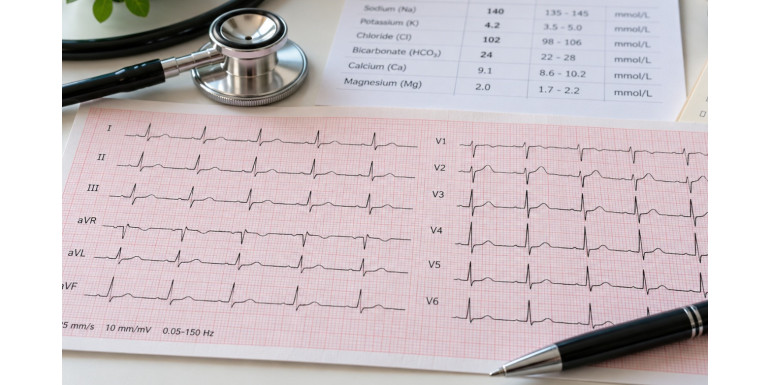 Elektrolity a EKG – potas, magnez i wapń
