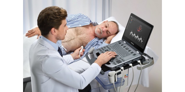 Jaki aparat USG dla fizjoterapeuty?