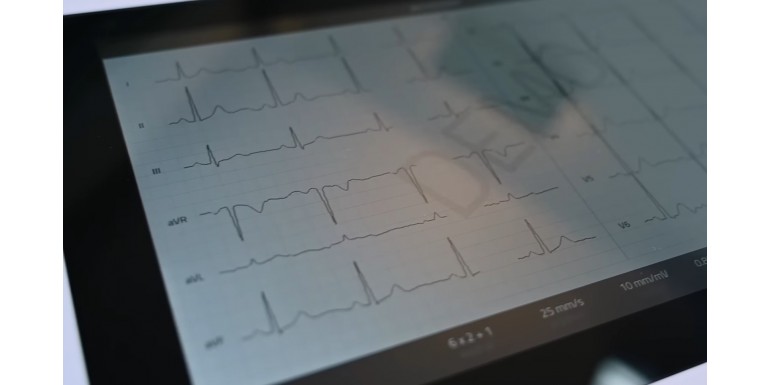 EKG bez tajemnic: najczęstsze pytania pacjentów o badanie, wynik i przygotowanie